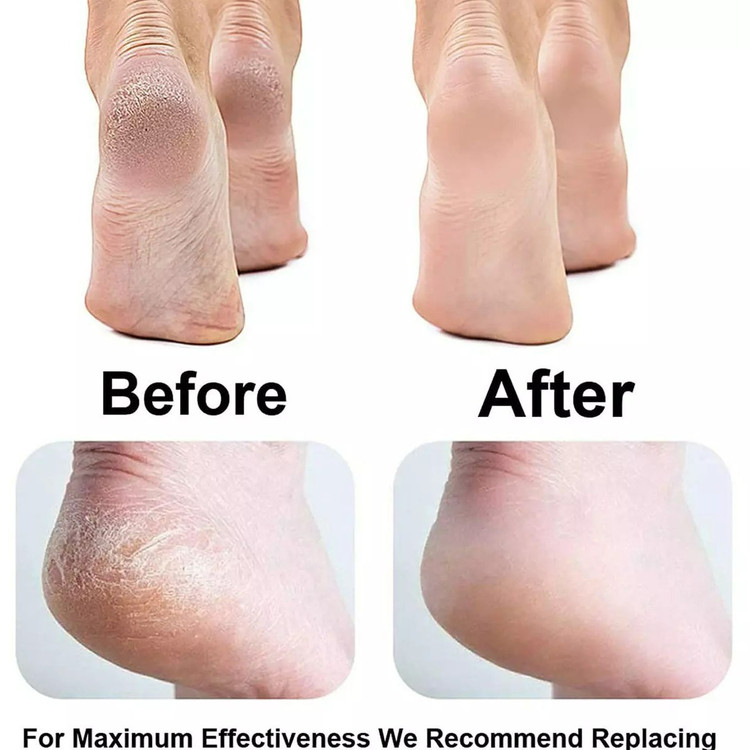 سنگ پا و سوهان برقی